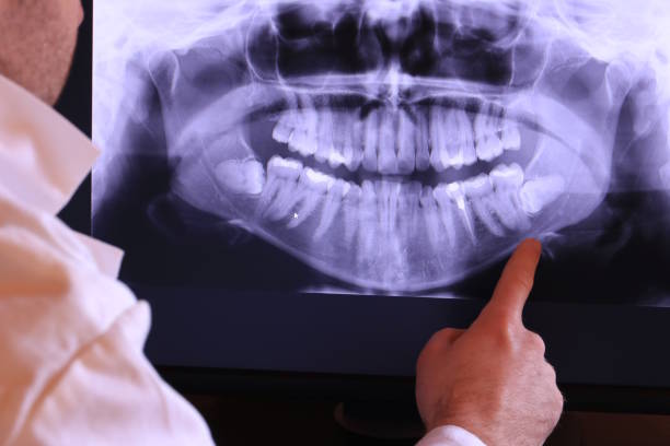 Best Emergency Treatment for Dental Infections or Abscesses in Walker Mill, MD