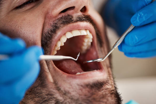 Best Pediatric Emergency Dentist in Walker Mill, MD